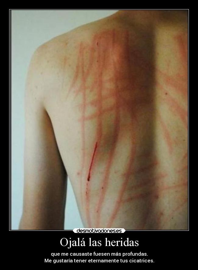 Ojalá las heridas -