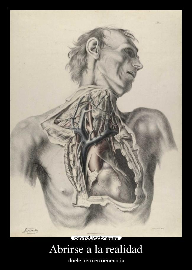 Abrirse a la realidad - duele pero es necesario