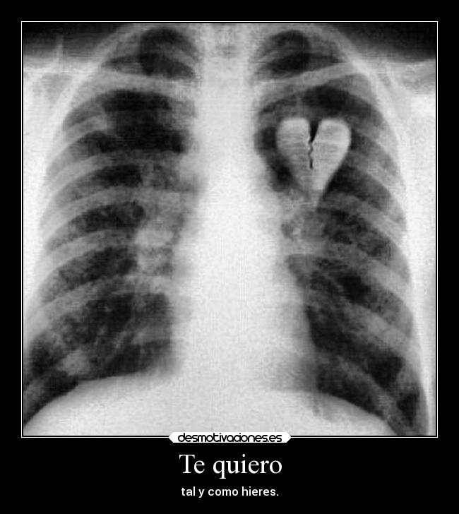 Te quiero - 