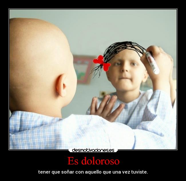 Es doloroso -