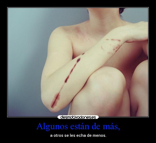 Algunos están de más, -