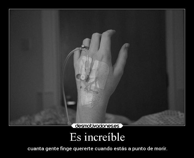 Es increíble - cuanta gente finge quererte cuando estás a punto de morir.