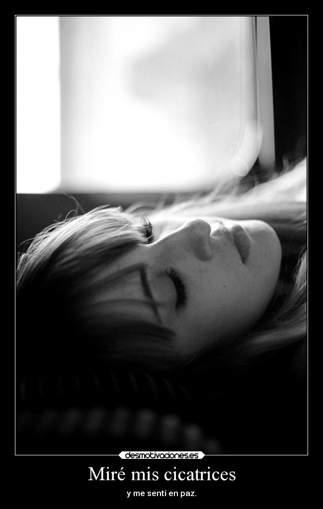 Miré mis cicatrices -