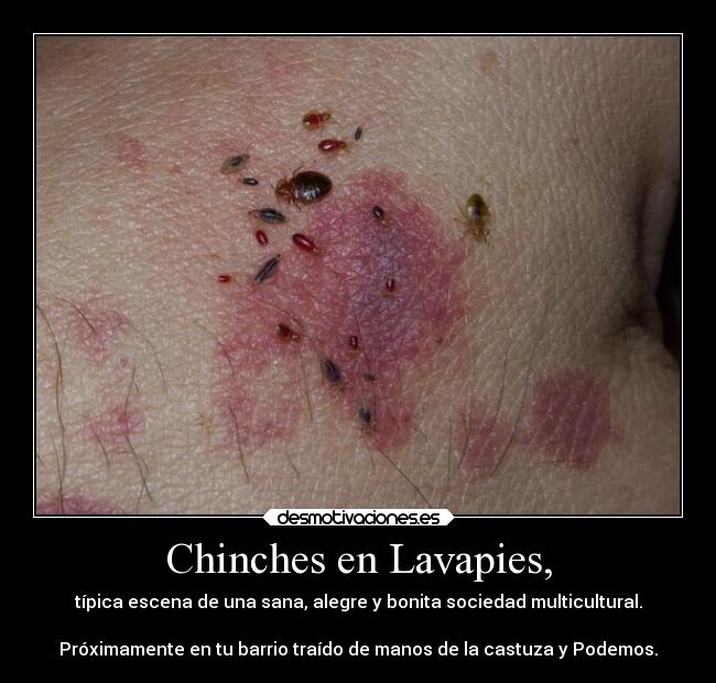 Chinches en Lavapies, - típica escena de una sana, alegre y bonita sociedad multicultural.

Próximamente en tu barrio traído de manos de la castuza y Podemos.