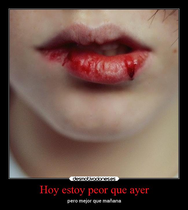 Hoy estoy peor que ayer -