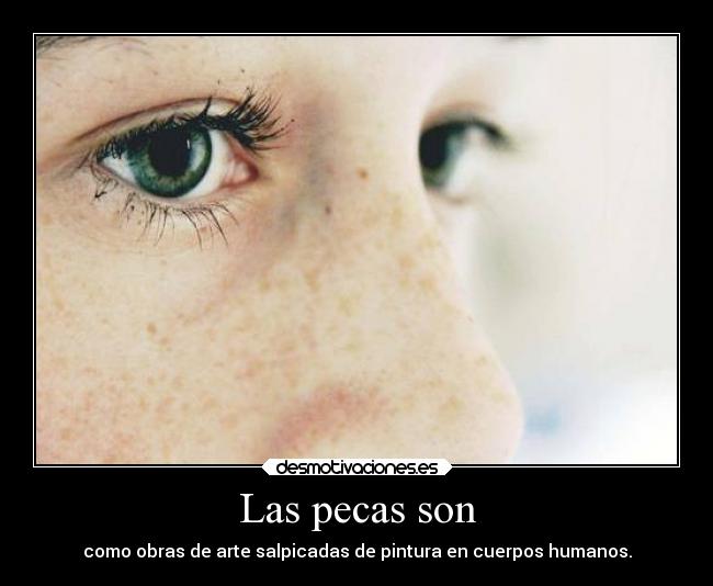Las pecas son - como obras de arte salpicadas de pintura en cuerpos humanos.