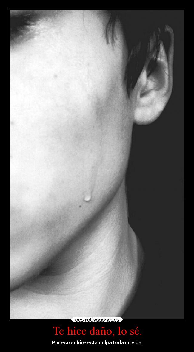 Te hice daño, lo sé. - 