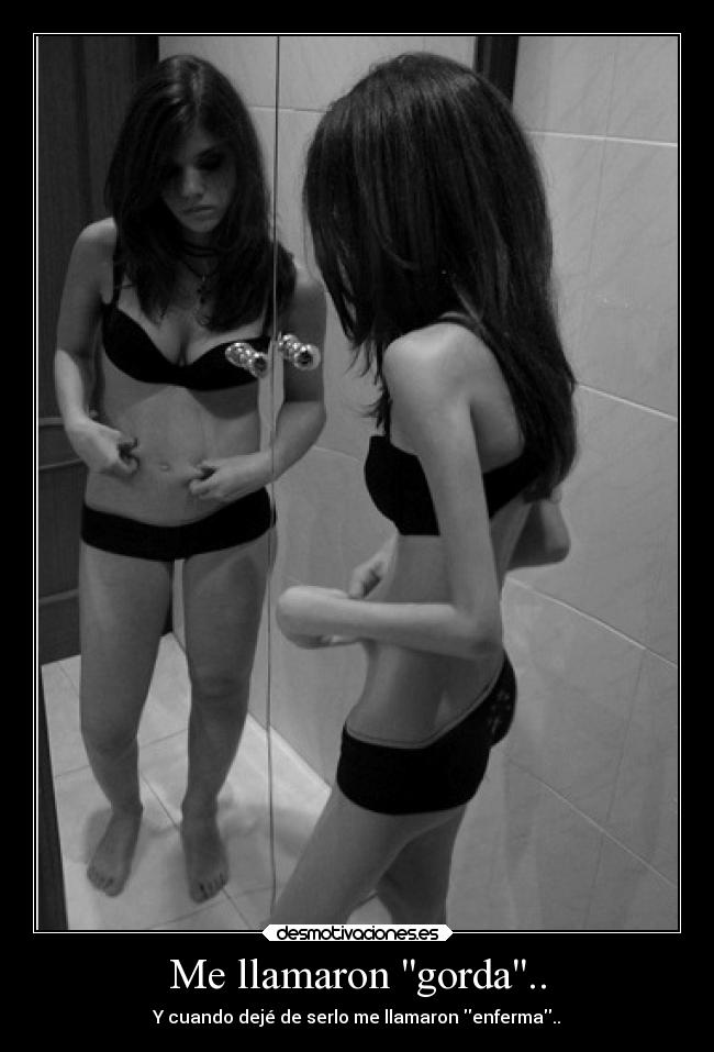 Me llamaron gorda.. - Y cuando dejé de serlo me llamaron enferma..