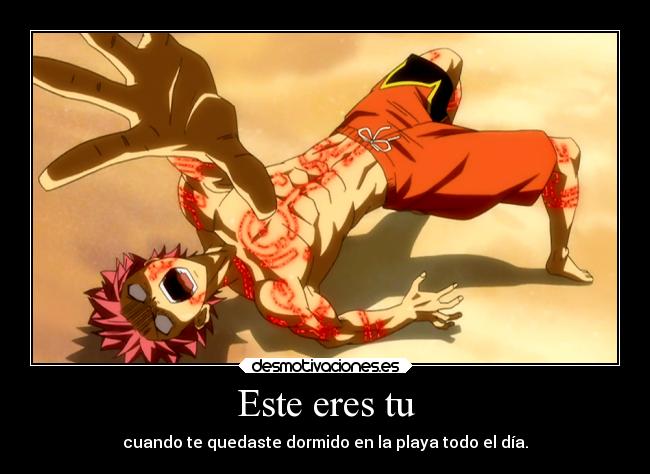 Este eres tu - cuando te quedaste dormido en la playa todo el día.