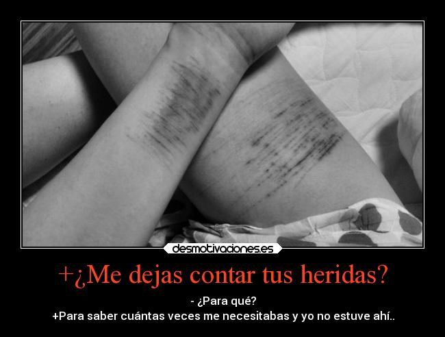 +¿Me dejas contar tus heridas? - 