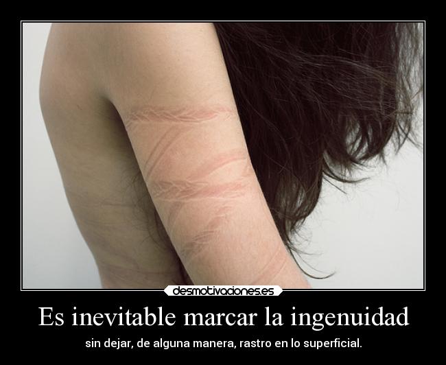 Es inevitable marcar la ingenuidad - 