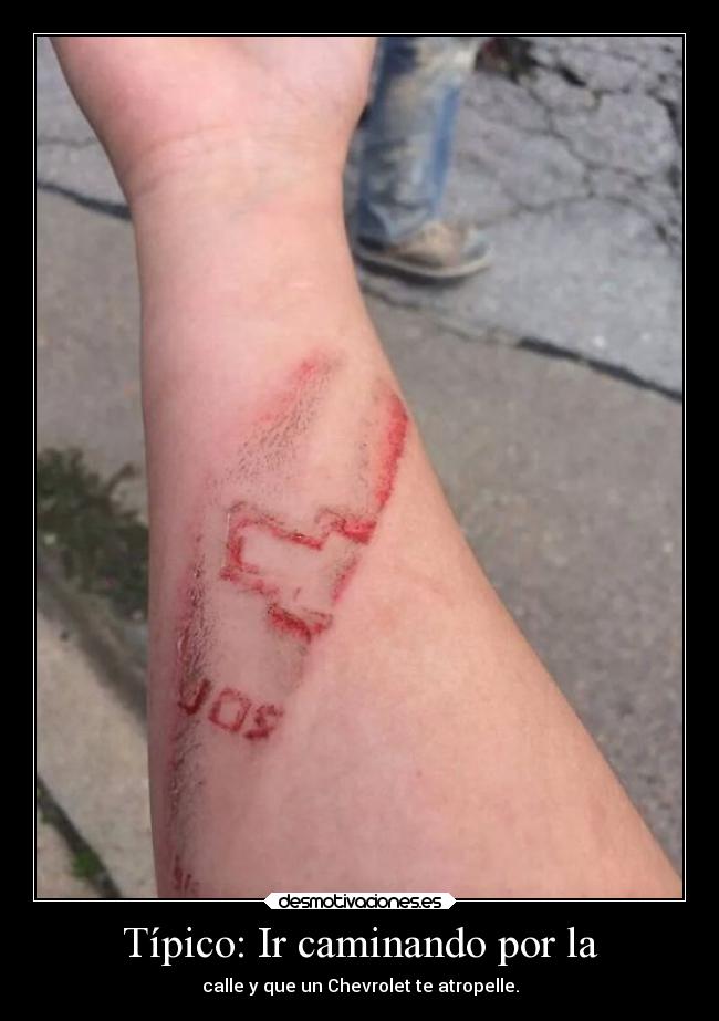 Típico: Ir caminando por la - calle y que un Chevrolet te atropelle.