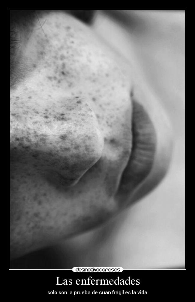 carteles imposible vida enfermedad realidad dannaconsentida desmotivaciones