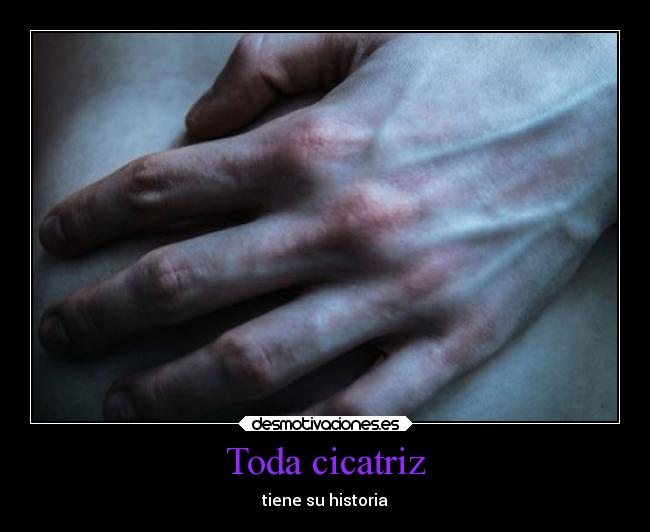 Toda cicatriz - tiene su historia