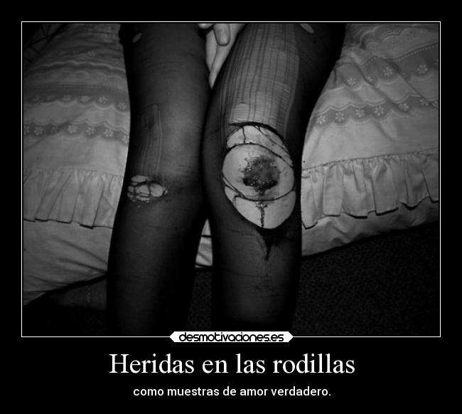Heridas en las rodillas - 