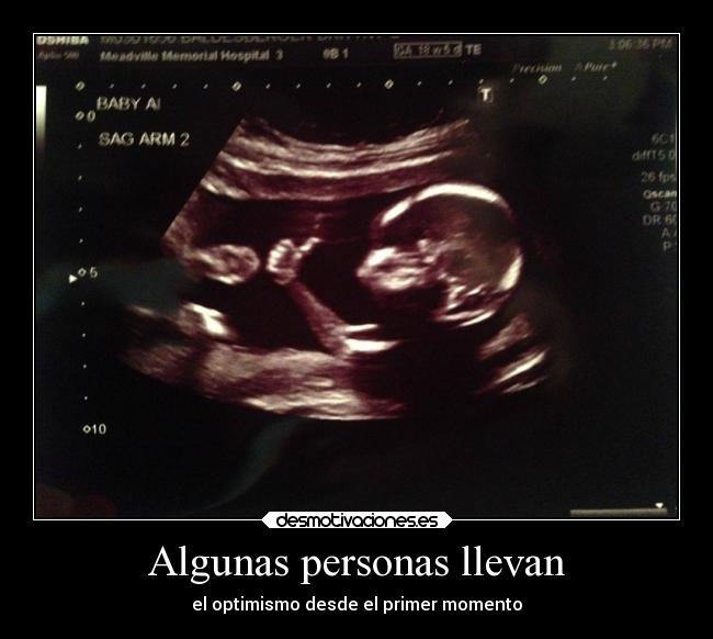 Algunas personas llevan - 