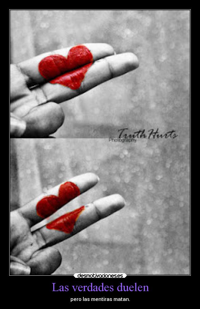 Las verdades duelen - pero las mentiras matan.