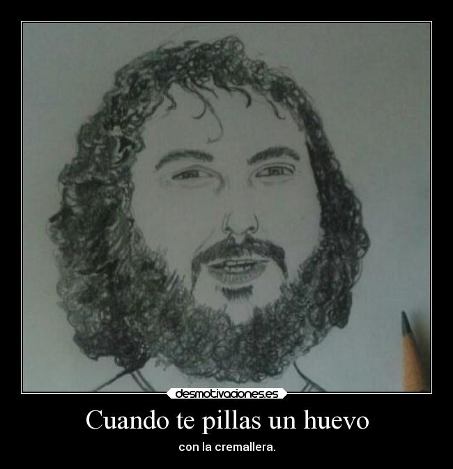 Cuando te pillas un huevo - con la cremallera.