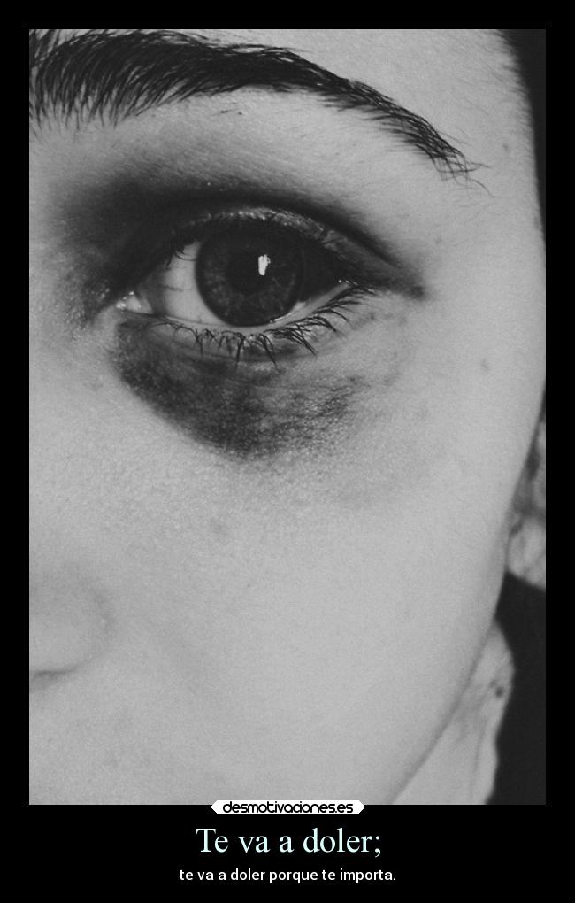 Te va a doler; - 