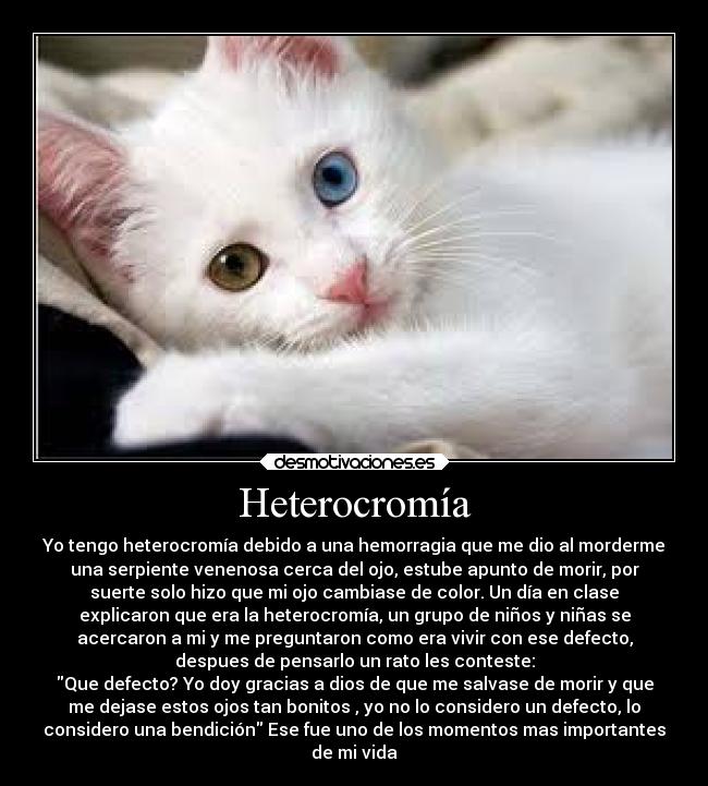 Heterocromía - Yo tengo heterocromía debido a una hemorragia que me dio al morderme
una serpiente venenosa cerca del ojo, estube apunto de morir, por
suerte solo hizo que mi ojo cambiase de color. Un día en clase
explicaron que era la heterocromía, un grupo de niños y niñas se
acercaron a mi y me preguntaron como era vivir con ese defecto,
despues de pensarlo un rato les conteste:
Que defecto? Yo doy gracias a dios de que me salvase de morir y que
me dejase estos ojos tan bonitos , yo no lo considero un defecto, lo
considero una bendición Ese fue uno de los momentos mas importantes
de mi vida