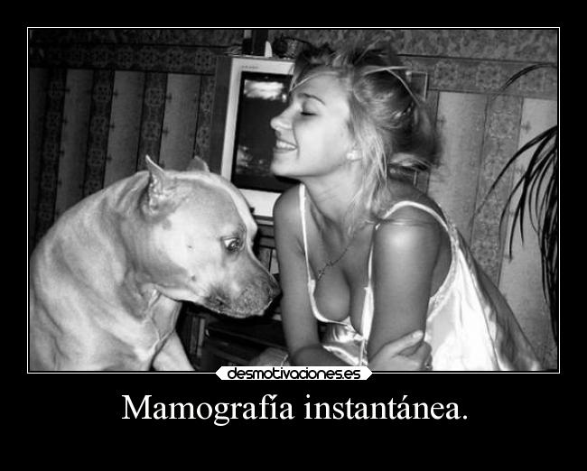 Mamografía instantánea. -