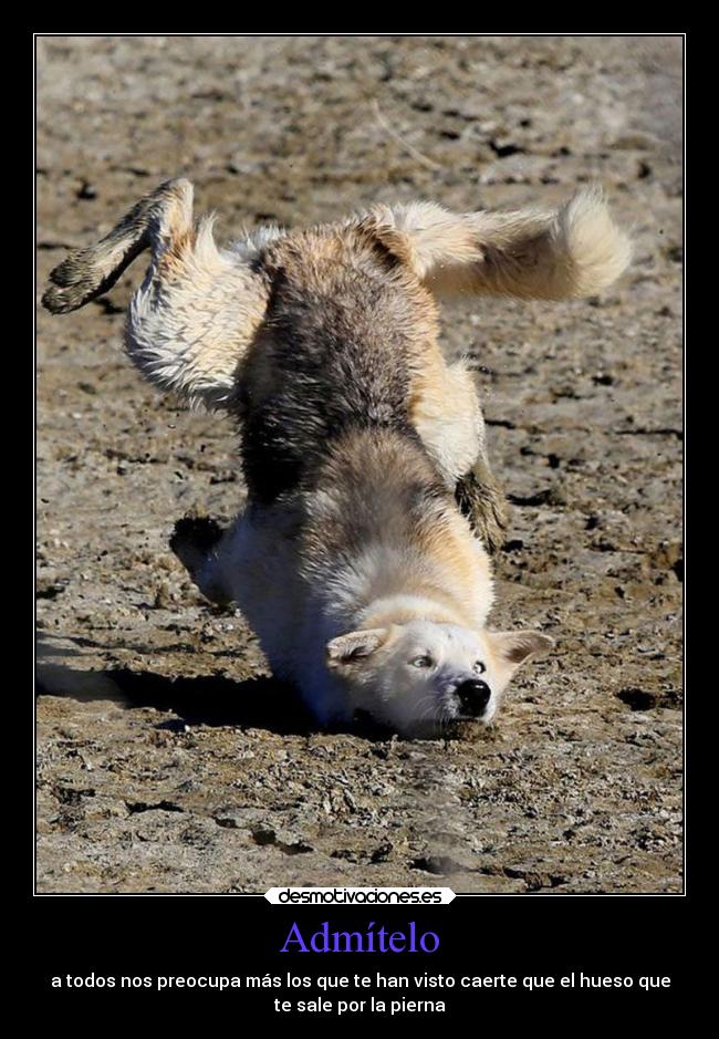 Admítelo - a todos nos preocupa más los que te han visto caerte que el hueso que
te sale por la pierna