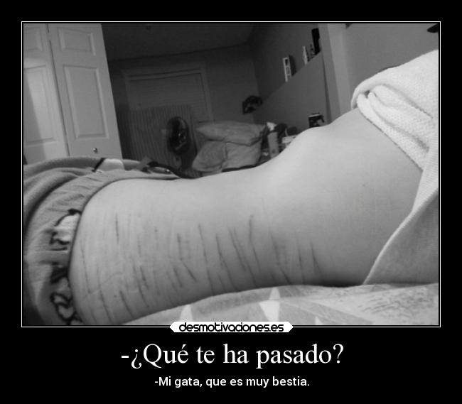 -¿Qué te ha pasado? - -Mi gata, que es muy bestia.
