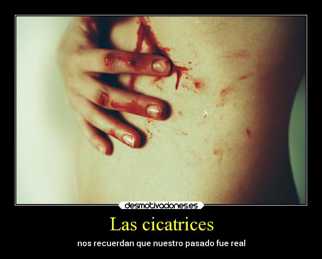Las cicatrices -