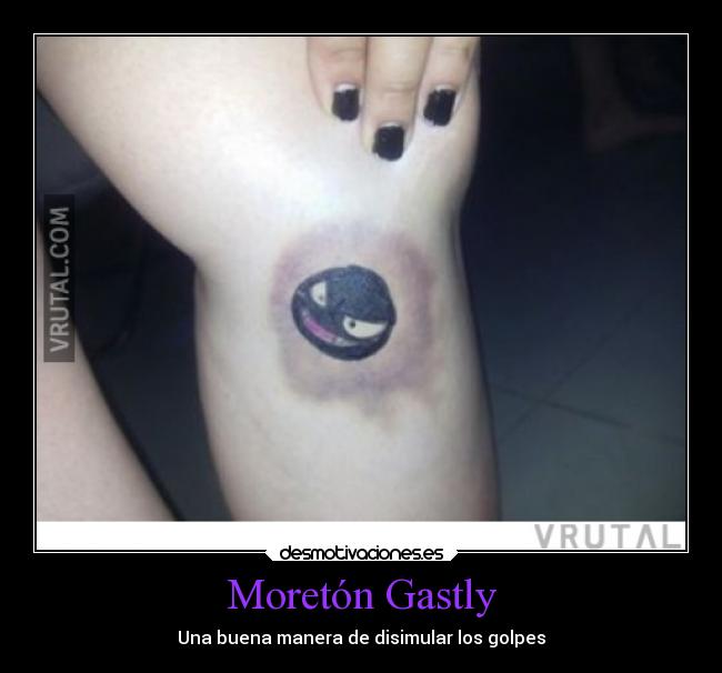Moretón Gastly - 