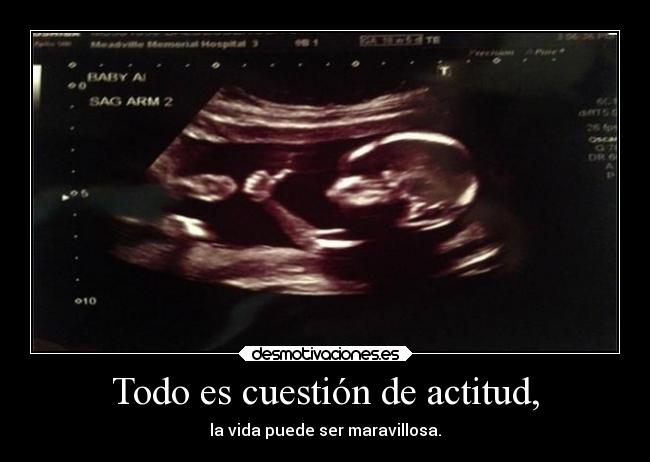 Todo es cuestión de actitud, - la vida puede ser maravillosa.