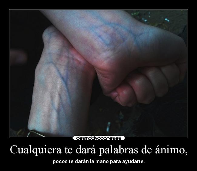 Cualquiera te dará palabras de ánimo, -