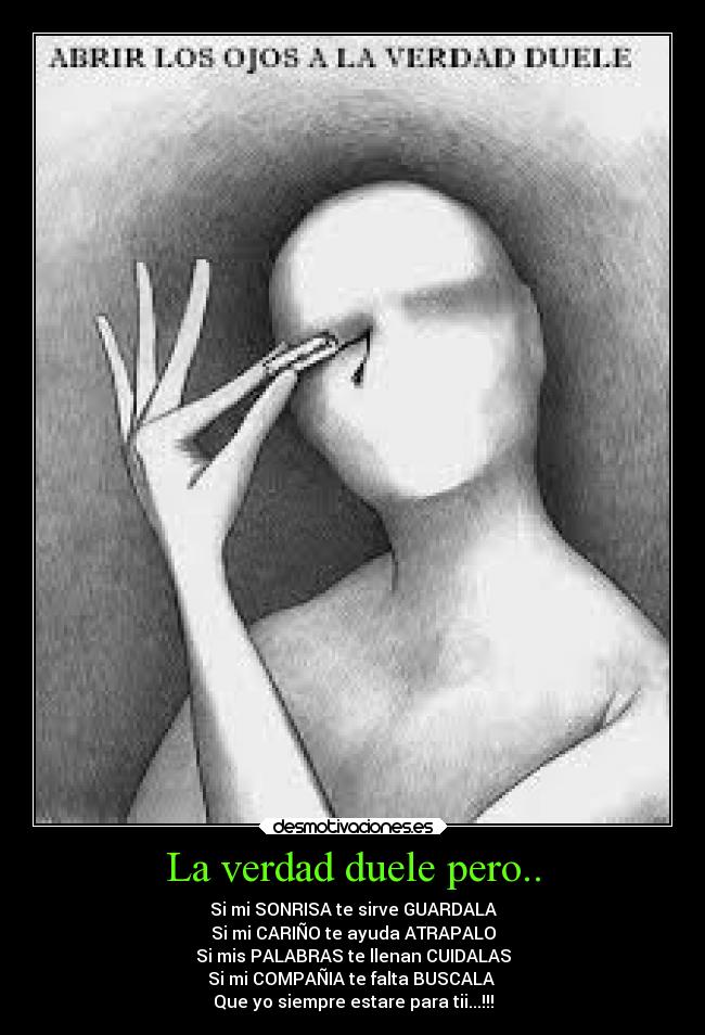 La verdad duele pero.. -