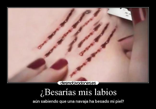 ¿Besarías mis labios - aún sabiendo que una navaja ha besado mi piel?