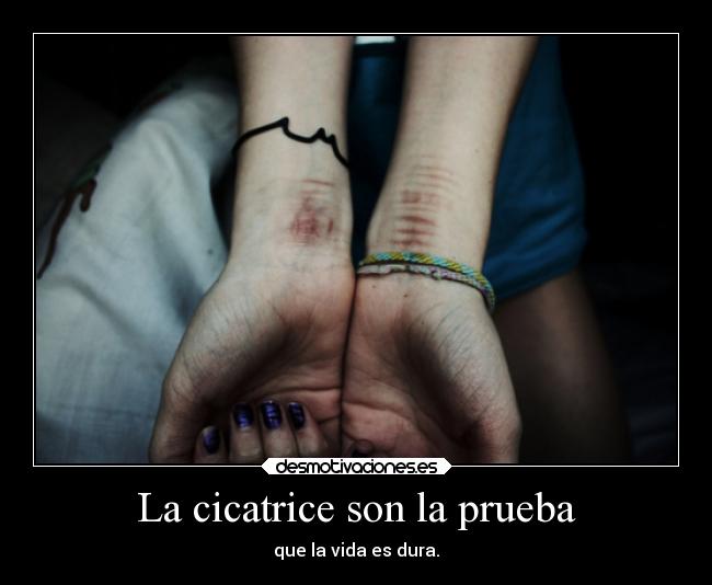 La cicatrice son la prueba -