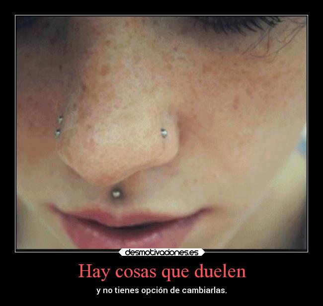 Hay cosas que duelen - y no tienes opción de cambiarlas.