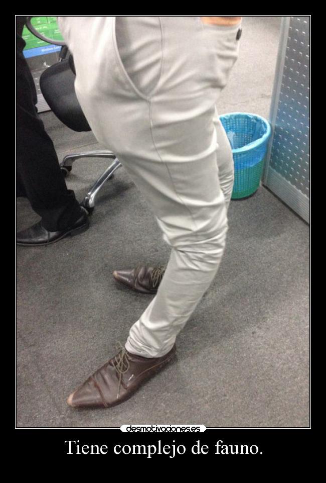 Tiene complejo de fauno. -