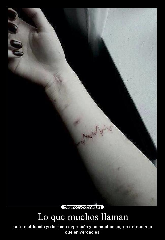 Lo que muchos llaman - auto-mutilación yo lo llamo depresión y no muchos logran entender lo
que en verdad es.