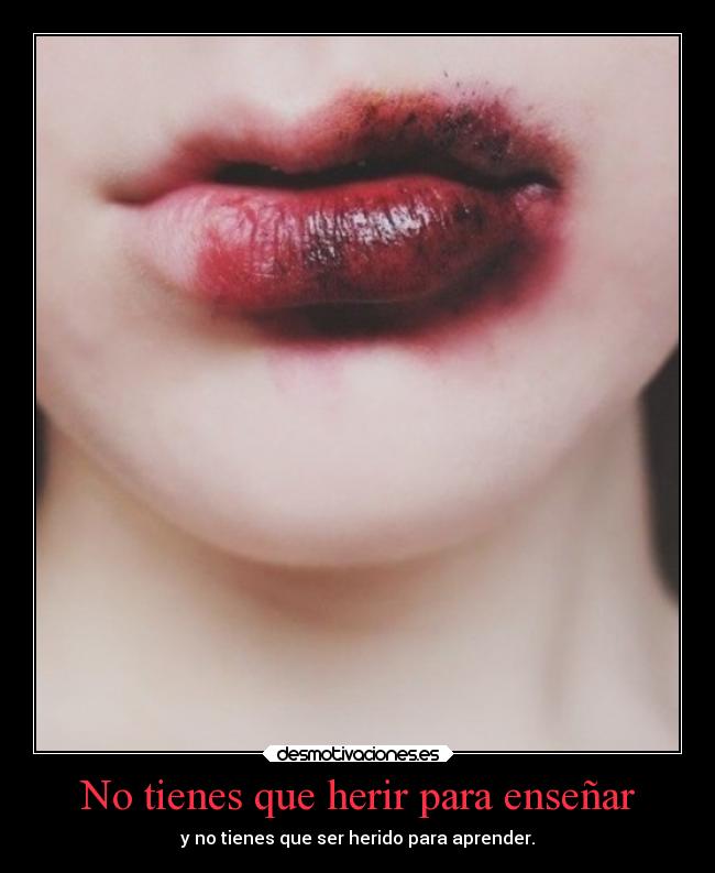 No tienes que herir para enseñar - y no tienes que ser herido para aprender.