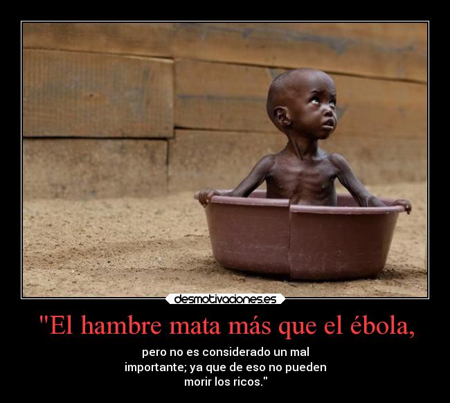 El hambre mata más que el ébola, - 