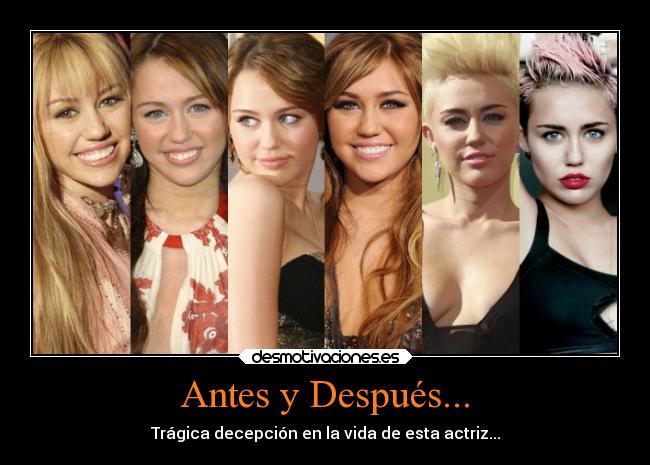 Antes y Después... - Trágica decepción en la vida de esta actriz...