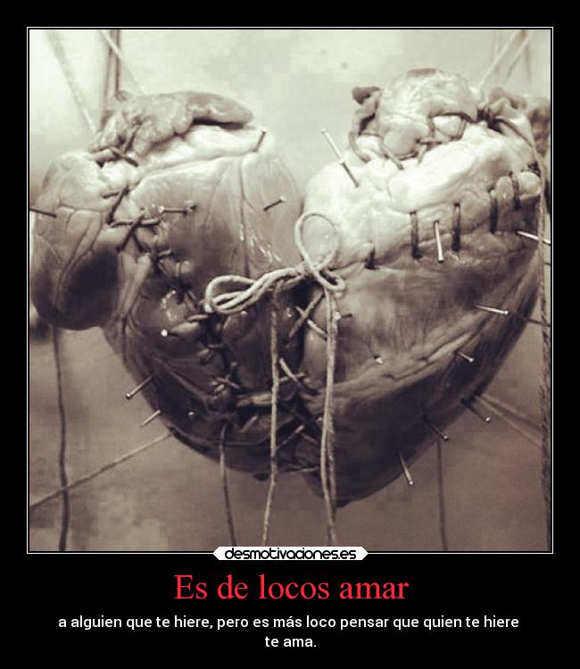Es de locos amar - 