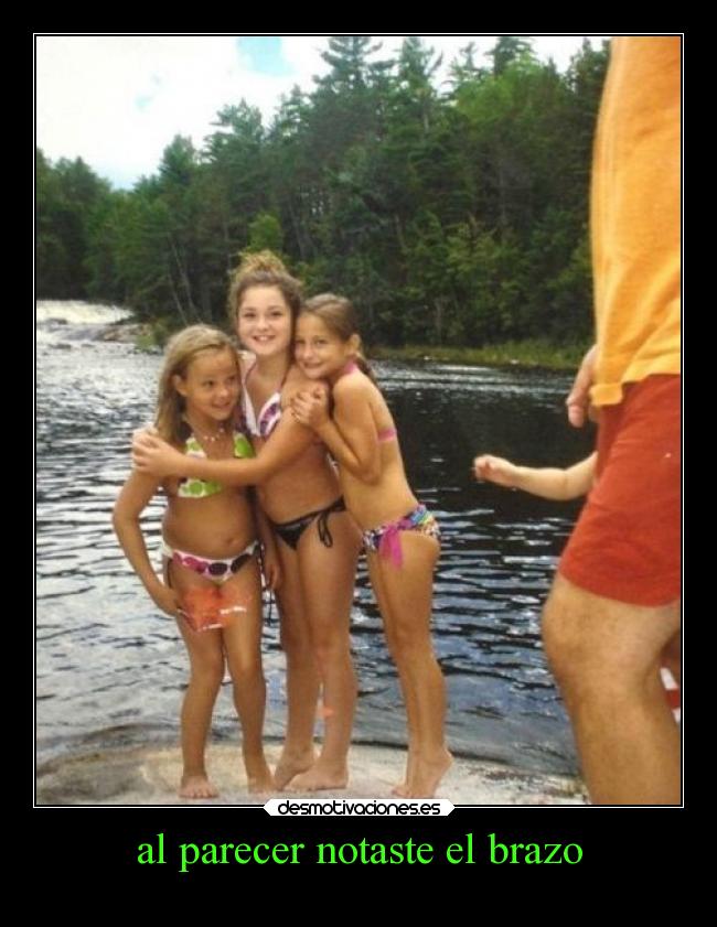 al parecer notaste el brazo -