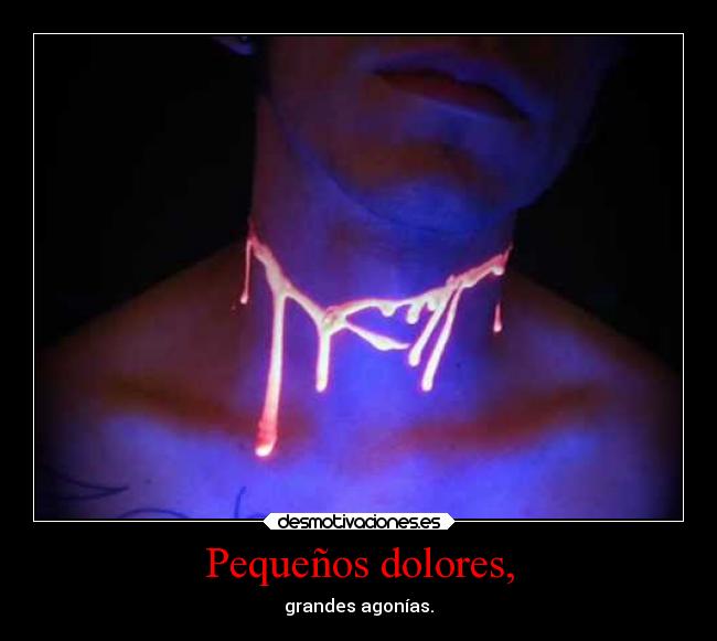 Pequeños dolores, - 