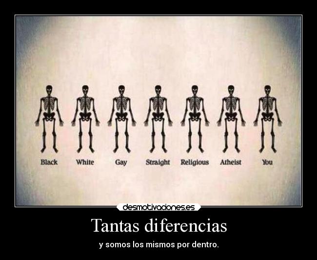 Tantas diferencias -