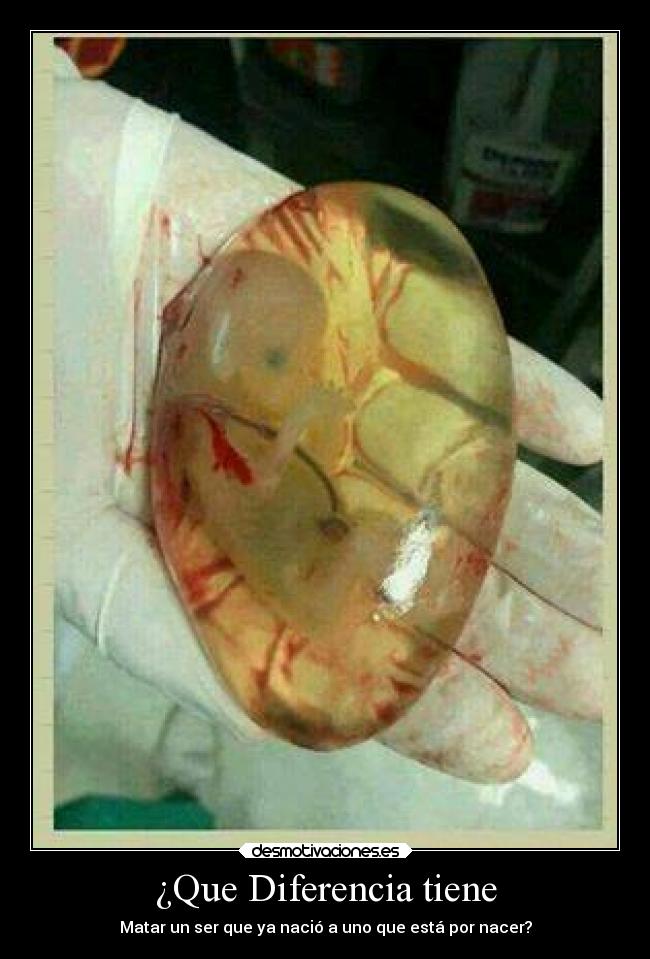¿Que Diferencia tiene - Matar un ser que ya nació a uno que está por nacer?