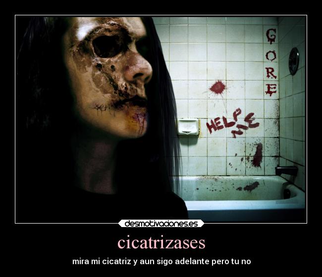 cicatrizases - mira mi cicatriz y aun sigo adelante pero tu no