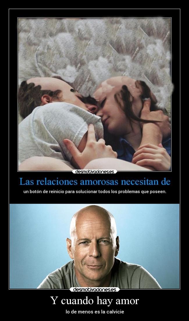 Y cuando hay amor - lo de menos es la calvicie