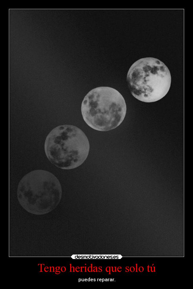 Tengo heridas que solo tú -