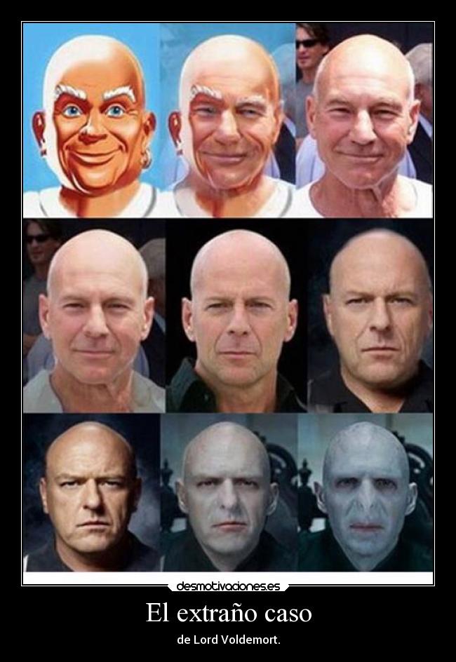 El extraño caso - de Lord Voldemort.