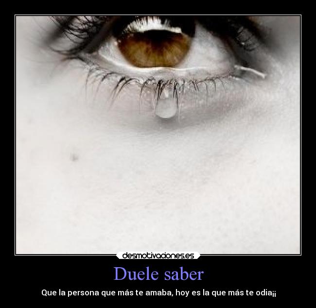 Duele saber -